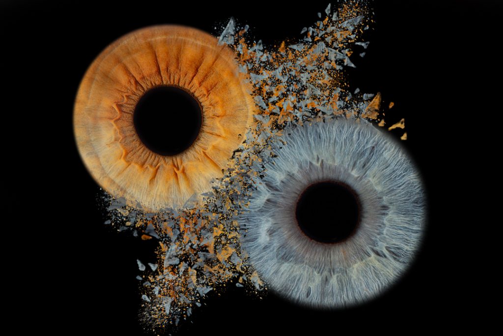 A blue and brown iris clash. Iris photography. Eye photography