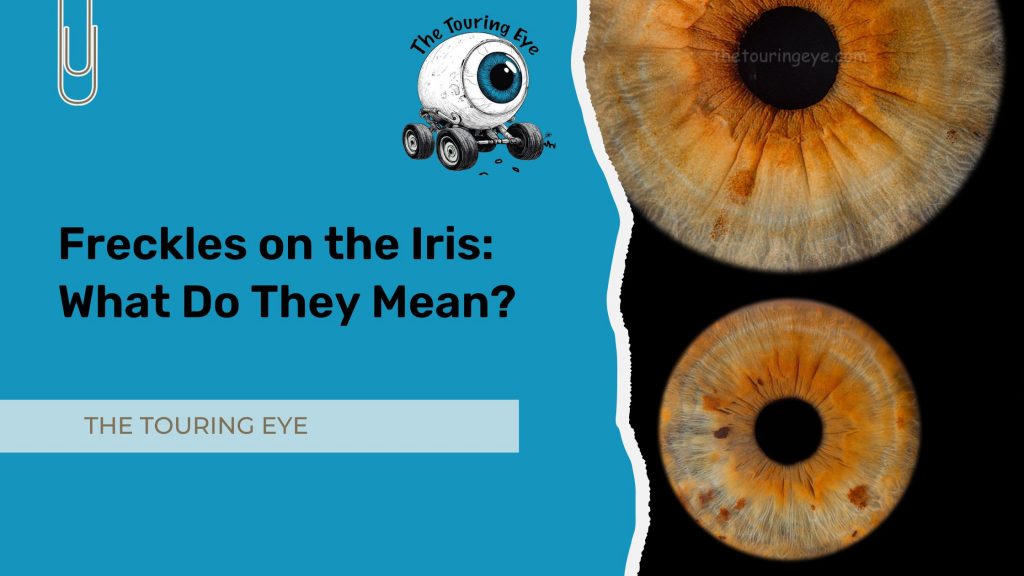 Freckles on the Iris: What Do They Mean? Iris Photography. Eye Photography. UK