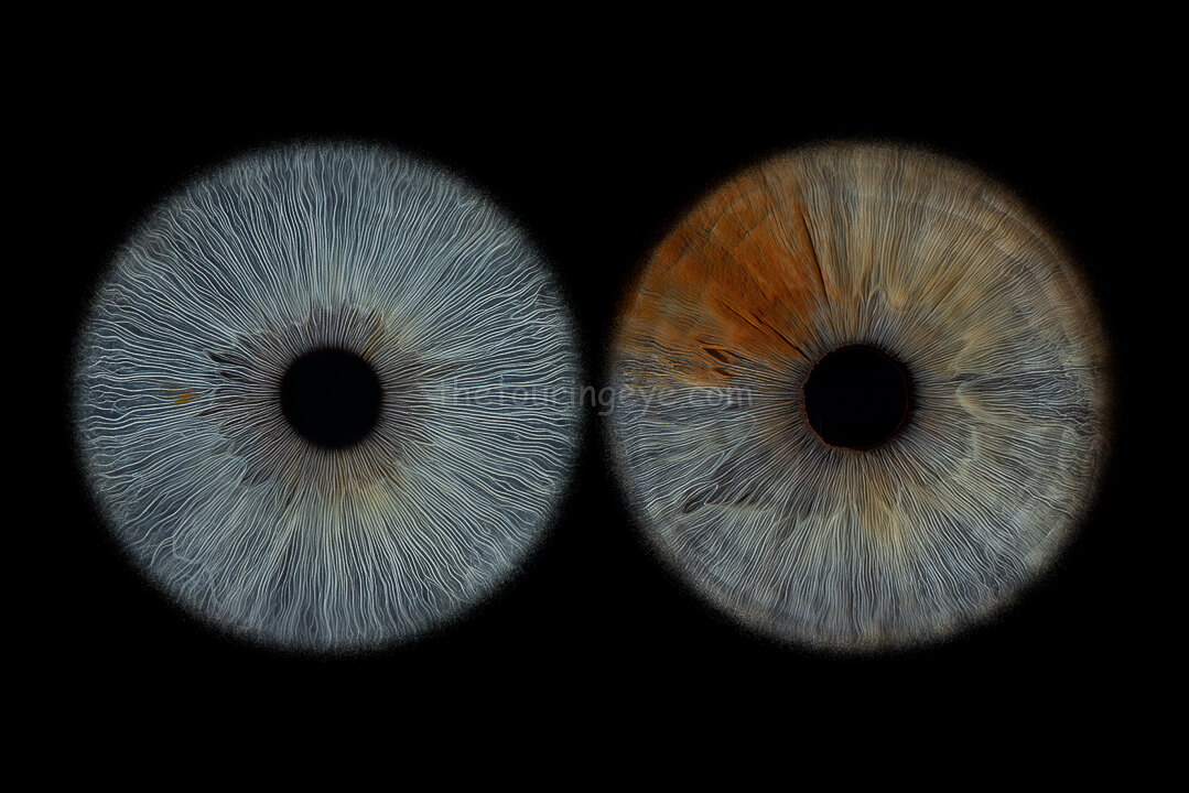 Highly detailed macro image of a blue and a blue with brown eye irises side by side. Iris photography. Eye photography. The Touring Eye. UK