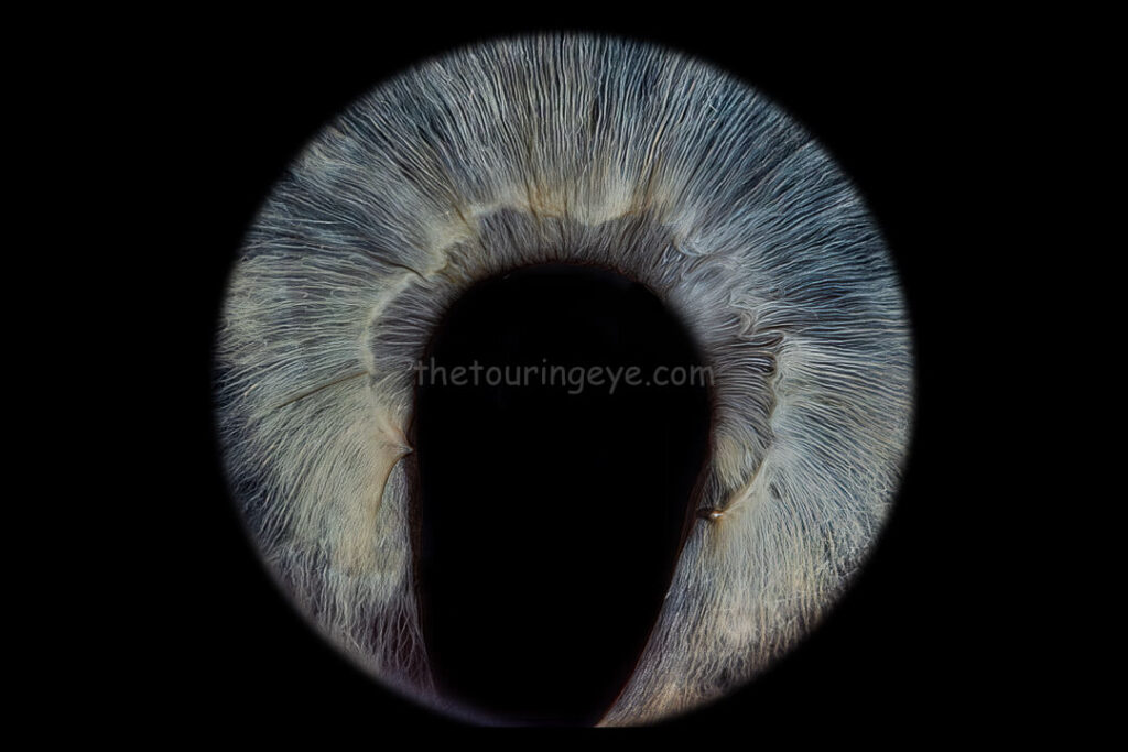 A closeup, highly detailed eye iris image showing a blue iris with a coloboma. Iris photography. Eye photography. The Touring Eye. UK