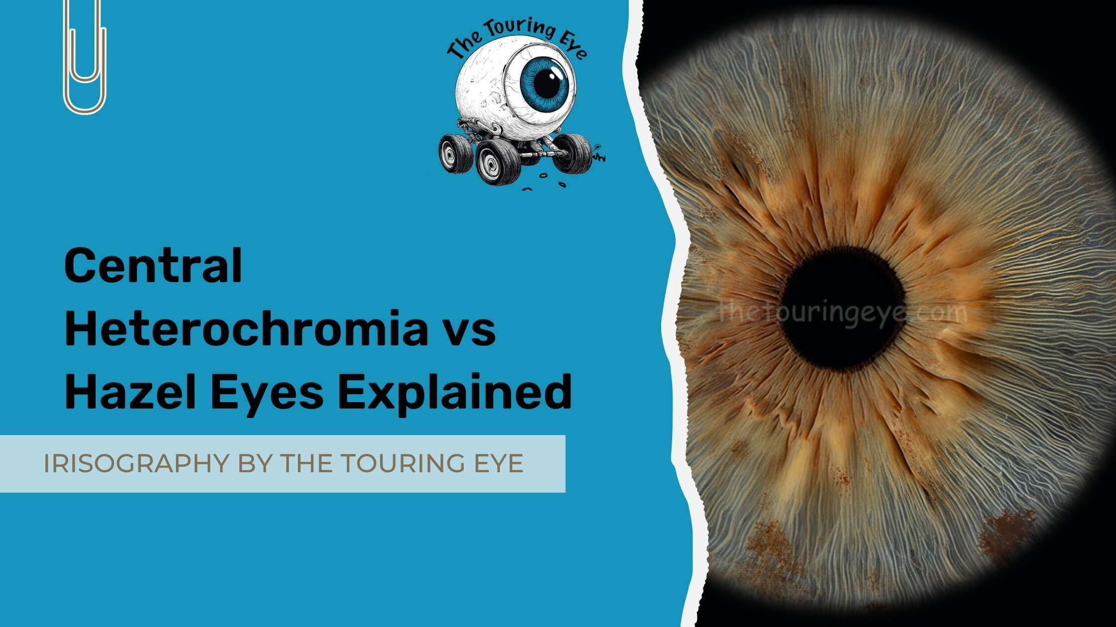 Central Heterochromia vs Hazel Eyes Explained